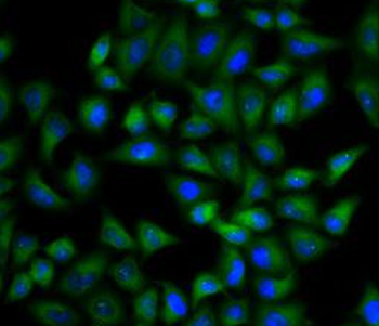 TPI1 Rabbit Polyclonal Antibody