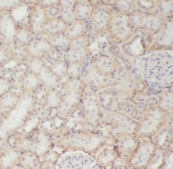 TPI1 Rabbit Polyclonal Antibody