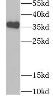 TPM2 Rabbit Polyclonal Antibody