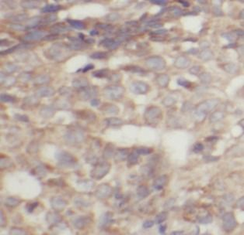 TPM2 Rabbit Polyclonal Antibody