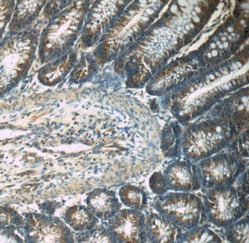 TPM3 Rabbit Polyclonal Antibody