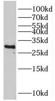 TPM4 Rabbit Polyclonal Antibody