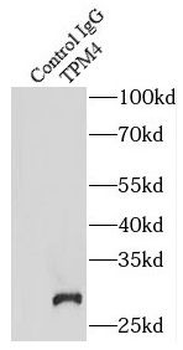 TPM4 Rabbit Polyclonal Antibody