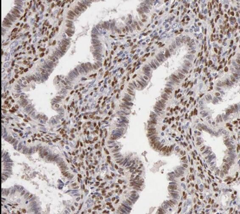 TPM4 Rabbit Polyclonal Antibody