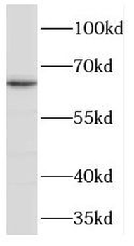 TPP1 Rabbit Polyclonal Antibody