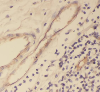 TPP1 Rabbit Polyclonal Antibody