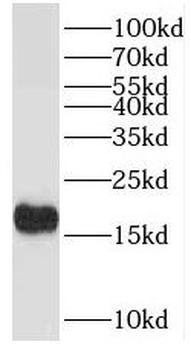 TPPP2 Rabbit Polyclonal Antibody