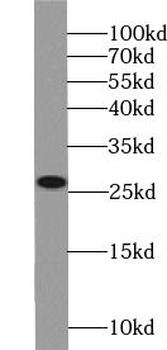TPSD1 Rabbit Polyclonal Antibody