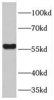 TPTE2 Rabbit Polyclonal Antibody