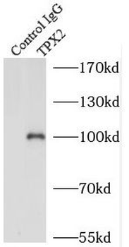 TPX2 Rabbit Polyclonal Antibody