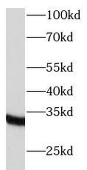 TRADD Rabbit Polyclonal Antibody
