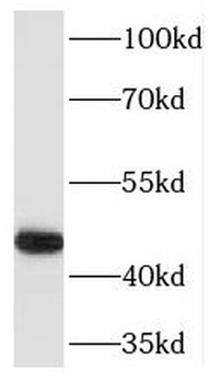 TRAF1 Rabbit Polyclonal Antibody