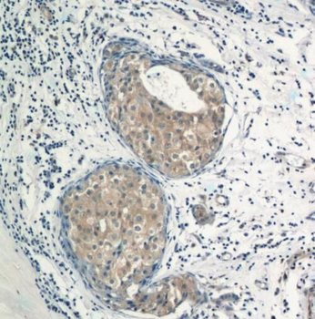 TRAF3IP1 Rabbit Polyclonal Antibody