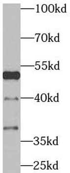 TRAF4 Rabbit Polyclonal Antibody
