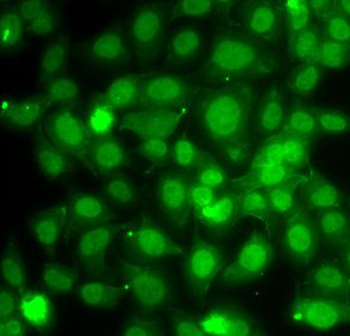 TRAF4 Rabbit Polyclonal Antibody