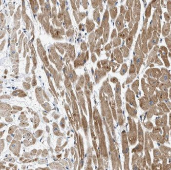 TRAF4 Rabbit Polyclonal Antibody