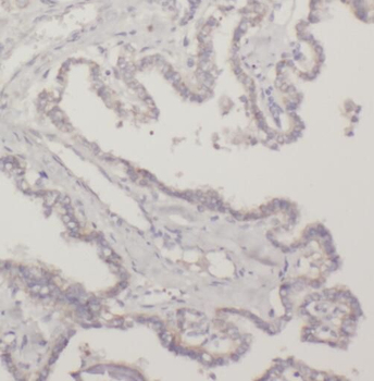TRAF5 Rabbit Polyclonal Antibody