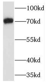 TRAF7 Rabbit Polyclonal Antibody
