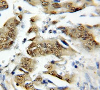 TRAF7 Rabbit Polyclonal Antibody