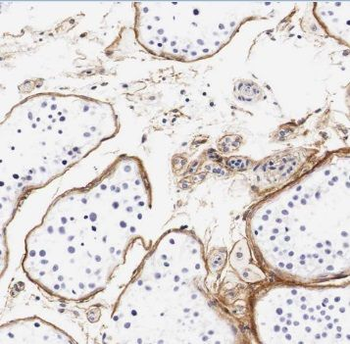 TF Mouse Monoclonal Antibody