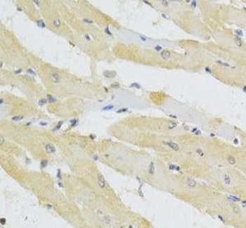 TRAP1 Rabbit Polyclonal Antibody