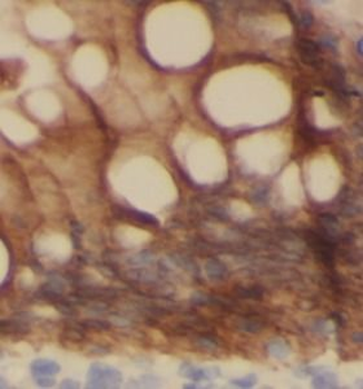 TFF3 Rabbit Polyclonal Antibody