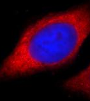 TREM1 Rabbit Polyclonal Antibody
