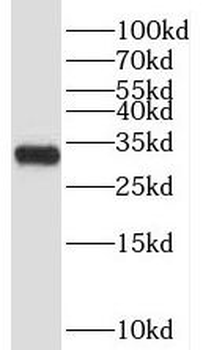 TRIAP1 Rabbit Polyclonal Antibody