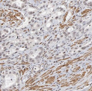 TRIM24 Rabbit Polyclonal Antibody