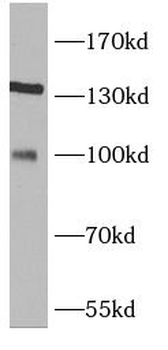 TRIM37 Rabbit Polyclonal Antibody