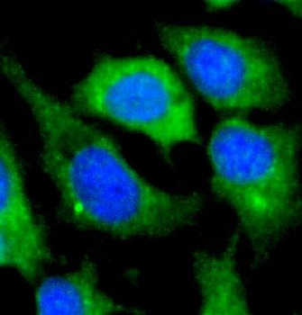 TRIM37 Rabbit Polyclonal Antibody