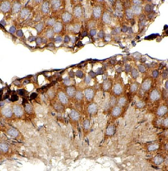 TRIM37 Rabbit Polyclonal Antibody