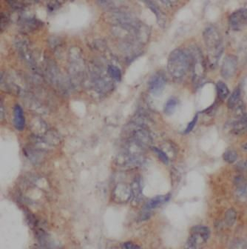 TRIM6 Rabbit Polyclonal Antibody