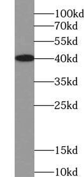 TRIM63 Rabbit Polyclonal Antibody