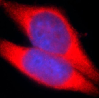 TRIM63 Rabbit Polyclonal Antibody