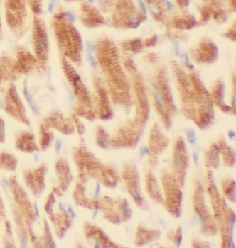 TRIM63 Rabbit Polyclonal Antibody