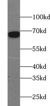 TRIM69 Rabbit Polyclonal Antibody