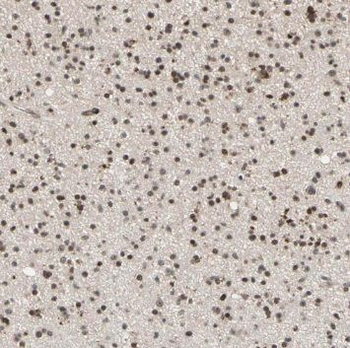 TRIM69 Rabbit Polyclonal Antibody