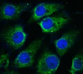 NTRK2 Rabbit Polyclonal Antibody