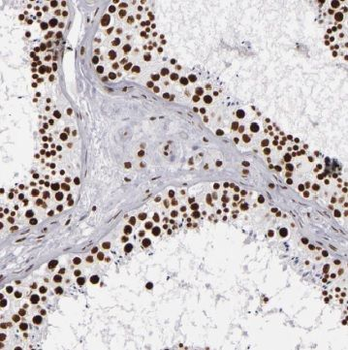TRMT6 Rabbit Polyclonal Antibody