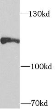 TRPA1 Rabbit Polyclonal Antibody