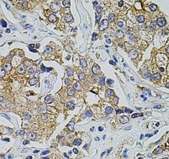 TRPA1 Rabbit Polyclonal Antibody