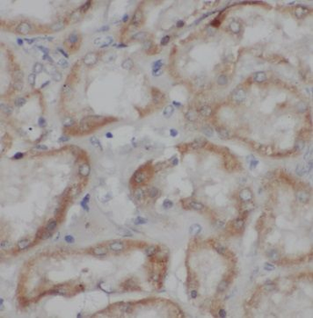 TRPC4 Rabbit Polyclonal Antibody