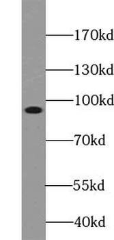 TRPC4AP Rabbit Polyclonal Antibody