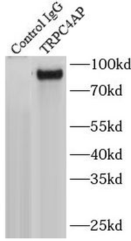 TRPC4AP Rabbit Polyclonal Antibody