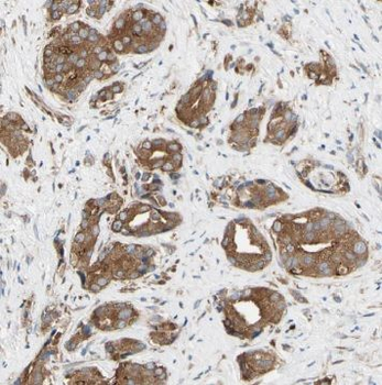 TRPC4AP Rabbit Polyclonal Antibody