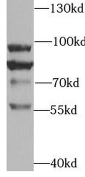TRPV4 Rabbit Polyclonal Antibody