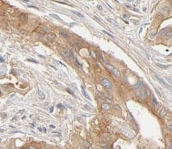 TXN2 Rabbit Polyclonal Antibody