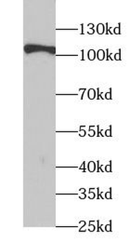 TSHR Rabbit Polyclonal Antibody