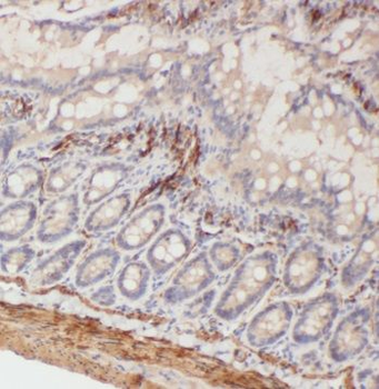 TSPAN1 Rabbit Polyclonal Antibody
